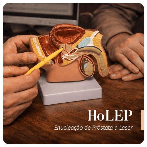 HoLEP — Enucleação de Próstata a Laser